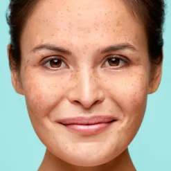 Biodermal Dagcrème Gevoelige Huid 50 ml