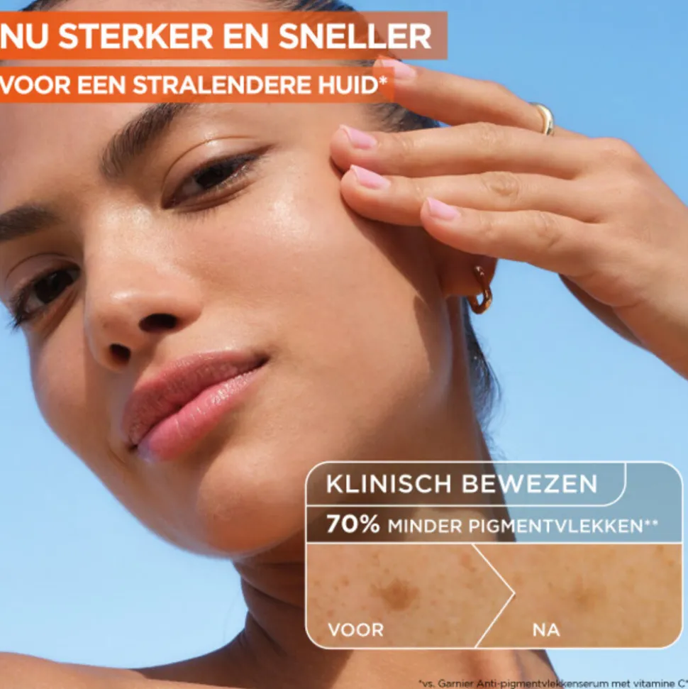 Garnier SkinActive Vitamine C Anti-Dark Spot Serum 30 ml