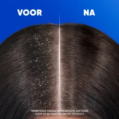 Head & Shoulders 2in1 Classic 400 ml