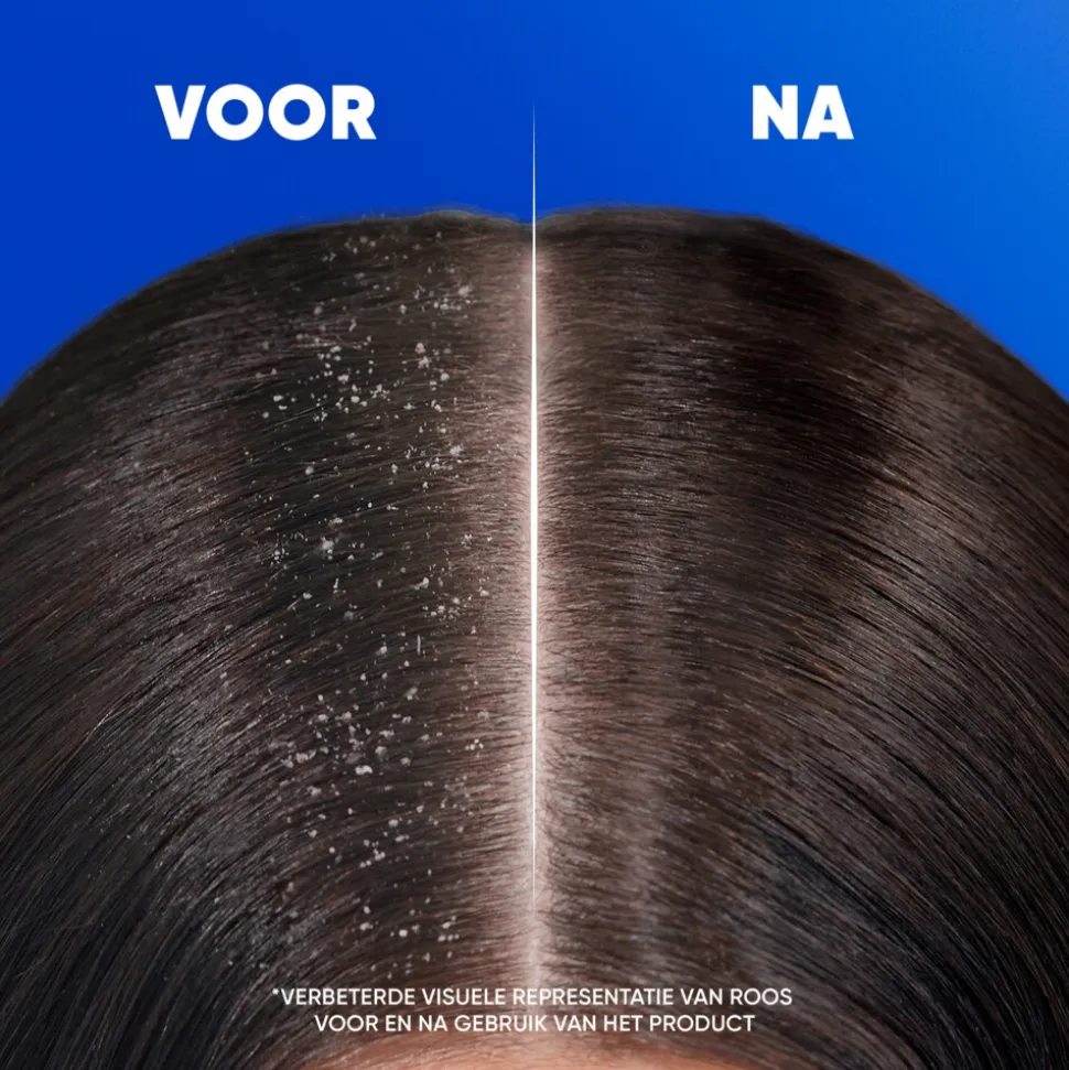 Head & Shoulders 2in1 Menthol Fresh 300 ml