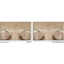 RoC Derm Correxion Fill+ Treat Serum 15 ml