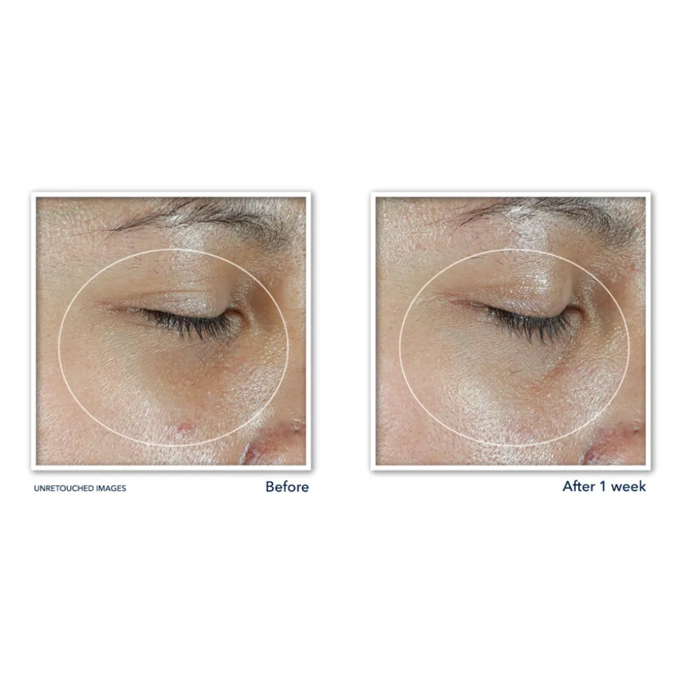 RoC Multi Correxion Revive + Glow Eye Stick 4 gr