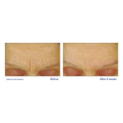 RoC Retinol Correxion Gezichtscrème Smoothing Max Hydration 50 ml