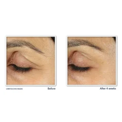 RoC Retinol Correxion Line Smoothing Oogcrème 15 ml