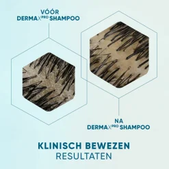 6x Head & Shoulders Anti-roos Shampoo DERMAxPRO Hydrateert 250 ml