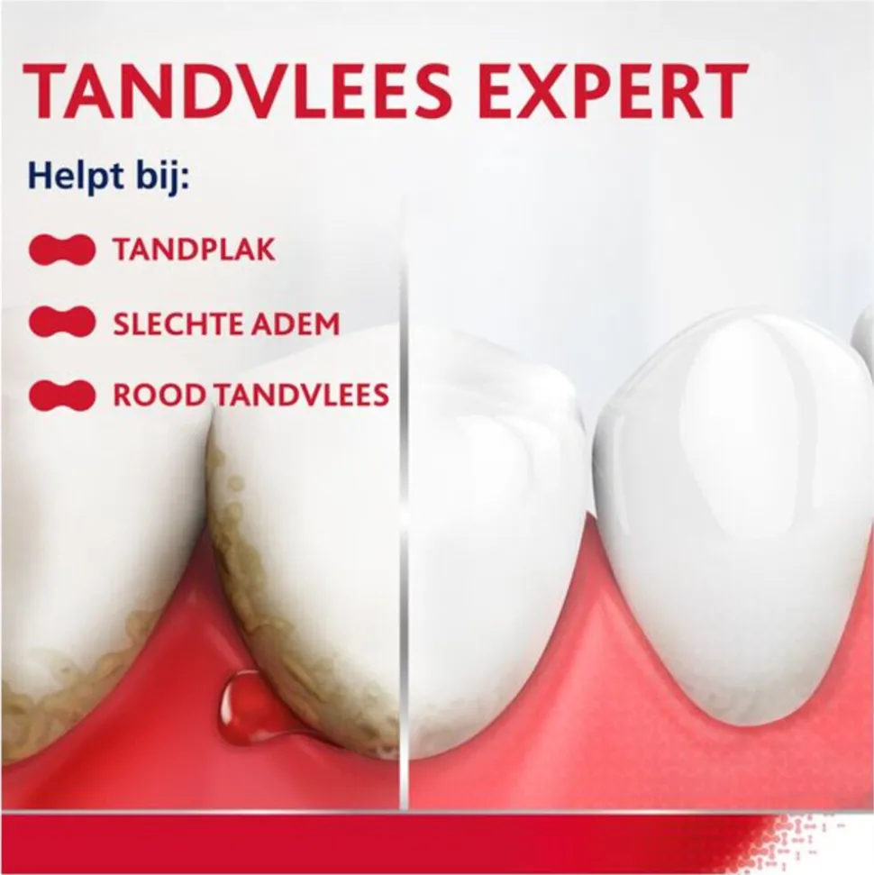 6x Parodontax Tandpasta bij Bloedend Tandvlees Original 75 ml